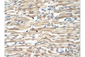 anti-YY1 Associated Factor 2 (YAF2) (AA 46-95) antibody