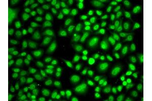 Immunofluorescence analysis of A549 cells using CREB1 antibody (ABIN4903374) at dilution of 1:100 (40x lens). (CREB1 anticorps)