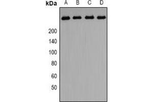 Western blot analysis of PIP5K expression in A549 (A), HepG2 (B), PC3 (C)rat testis (D) whole cell lysates.