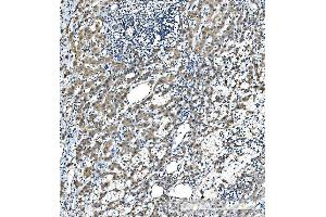 IHC analysis of CYP7A1 using anti-CYP7A1 antibody (ABIN7599604).