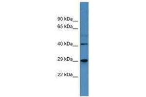 Image no. 1 for anti-Carbonic Anhydrase II (CA2) (AA 130-179) antibody (ABIN6746751) (CA2 anticorps  (AA 130-179))