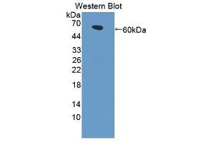 Western Blotting (WB) image for anti-Low Density Lipoprotein Receptor-Related Protein 4 (LRP4) (AA 1610-1885) antibody (ABIN1869037)