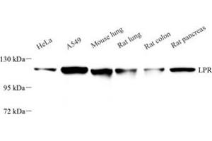 Western blot analysis of LRP (ABIN7074548) at dilution of 1: 500 (MVP anticorps)