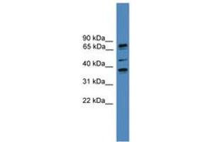 Image no. 1 for anti-Bardet-Biedl Syndrome 5 (BBS5) (N-Term) antibody (ABIN6746105) (BBS5 anticorps  (N-Term))