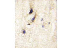 Formalin-fixed and paraffin-embedded human brain tissue reacted with DM1 Antibody (C-term) (ABIN389180 and ABIN2839343) , which was peroxidase-conjugated to the secondary antibody, followed by DAB staining. (DAAM1 anticorps  (C-Term))