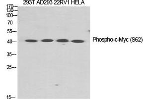 Western Blotting (WB) image for anti-Myc Proto-Oncogene protein (MYC) (pSer62) antibody (ABIN5959056) (c-MYC anticorps  (pSer62))