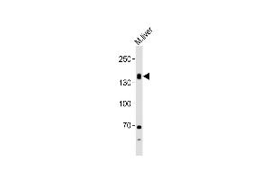 Anti-TSHR Antibody (Center) at 1:1000 dilution + mouse liver lysates Lysates/proteins at 20 μg per lane. (TSH receptor anticorps  (AA 217-252))