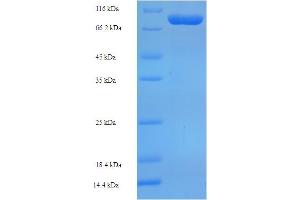 SDS-PAGE (SDS) image for Crossover junction endonuclease EME1 (EME1) (AA 1-583) protein (His-SUMO Tag) (ABIN5711711)