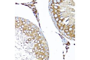 Immunohistochemistry of paraffin-embedded rat testis using TST Rabbit pAb  at dilution of 1:200 (40x lens).