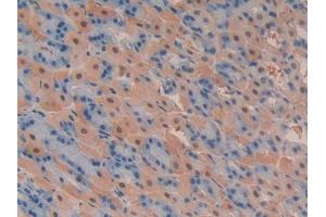 DAB staining on IHC-P; Samples: Mouse Stomach Tissue (PIK3C2A anticorps  (AA 349-611))