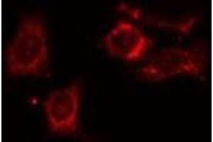 ABIN6275406 staining HT29 cells by IF/ICC. (NDRG4 anticorps  (Internal Region))