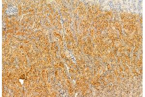 ABIN6262815 and ABIN6272922 at 1/100 staining Rat kidney tissue by IHC-P. (FERMT2 anticorps  (C-Term))
