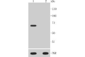 Lane 1: Hela treated with Calyculin A and TNF-alpha whole cell lysates, Lane 2: Untreated Hela whole cell lysates, probed with PKR(T446) (10A1) Monoclonal Antibody  at 1:1000 overnight at 4˚C. (EIF2AK2 anticorps  (pThr446))
