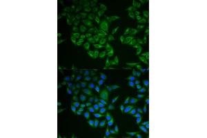 Immunofluorescence analysis of A549 cell using CD247 antibody. (CD247 anticorps)