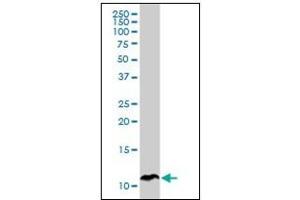 Western Blotting (WB) image for anti-serine Peptidase Inhibitor, Kazal Type 1 (SPINK1) antibody (ABIN781831)
