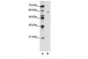 Image no. 1 for anti-BTB (POZ) Domain Containing 14A (BTBD14A) (AA 491-540) antibody (ABIN6736109) (BTBD14A anticorps  (AA 491-540))