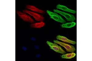 ABIN6262635 and ABIN6273051 staining Hela cells by IF/ICC.