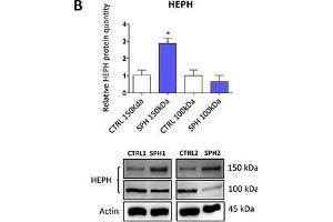 Iron export machinery-related hephaestin (HEPH) and the hemochromatosis gene (HFE) related to systemic iron loading are elevated at the mRNA level but not on the protein level in tumor-initiating cells (TICs)Expression of the HEPH gene at the mRNA level in breast non-malignant cell line MCF10A, in TICs derived from breast cancer cell lines MCF-7, BT-474, T-47D and ZR-75-30 as well as from prostate cancer cell lines DU-145 and LNCaP has been determined (A) together with protein levels in the MCF-7 cell line (CTRL) and MCF-7 derived spheres (SPH) (B). (Hephaestin anticorps  (AA 21-120))