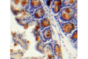 IHC-P analysis of Intestine tissue, with DAB staining.