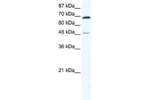 WB Suggested Anti-ZNF35 Antibody Titration:  0. (ZNF35 anticorps  (N-Term))