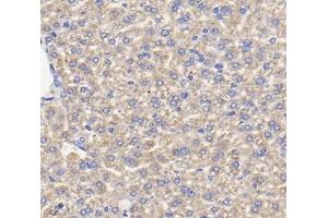 Immunohistochemistry analysis of paraffin-embedded mouse liver using,TFR2 (ABIN7075965) at dilution of 1: 400 (Transferrin Receptor 2 anticorps)