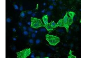 Anti-RASSF1 mouse monoclonal antibody (ABIN2454274) immunofluorescent staining of COS7 cells transiently transfected by pCMV6-ENTRY RASSF1 (RC213525). (RASSF1 anticorps)
