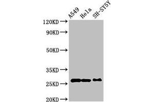 Western Blot Positive WB detected in: A549 whole cell lysate, Hela whole cell lysate, SH-SY5Y whole cell lysate All lanes: PRDX6 antibody at 4 μg/mL Secondary Goat polyclonal to rabbit IgG at 1/50000 dilution Predicted band size: 26 kDa Observed band size: 26 kDa (Peroxiredoxin 6 anticorps  (AA 87-224))
