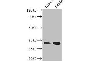 Western Blot Positive WB detected in: Mouse liver tissue, Mouse brain tissue All lanes: CD37 antibody at 2. (CD37 anticorps  (AA 109-237))