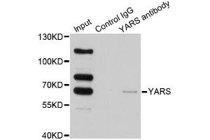 Immunoprecipitation analysis of 200ug extracts of HeLa cells using 1ug YARS antibody. (YARS anticorps)
