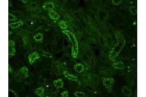 Formalin-fixed and paraffin embedded human kidney labeled with Rabbit Anti-Mitofusin 2 Polyclonal Antibody, Unconjugated used at 1:200 dilution for 40 minutes at 37°C.