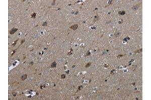 The image on the left is immunohistochemistry of paraffin-embedded Human brain tissue using ABIN7129446(FAM89B Antibody) at dilution 1/30, on the right is treated with fusion protein. (FAM89B anticorps)