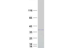 Validation with Western Blot