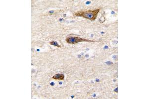 Formalin-fixed and paraffin-embedded human brain tissue reacted with CYP2R1 antibody (Center), which was peroxidase-conjugated to the secondary antibody, followed by DAB staining. (CYP2R1 anticorps  (AA 152-180))