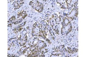 IHC analysis of MCM7 using anti-MCM7 antibody (ABIN7601968). (MCM7 anticorps  (AA 526-719))