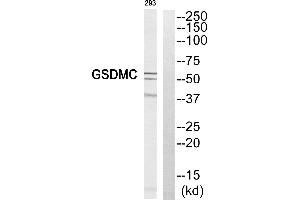 Western blot analysis of extracts from 293 cell, using GSDMC antibody. (MLZE anticorps  (Internal Region))