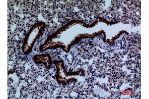 Immunohistochemistry (IHC) analysis of paraffin-embedded Mouse Lung, antibody was diluted at 1:100. (DPYD anticorps  (Internal Region))