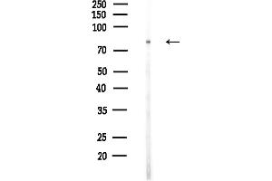 Western blot analysis of lysates from Hela cells(heat-shock,45 min treatment), using VPS16 Antibody at 1/1000 dilution.