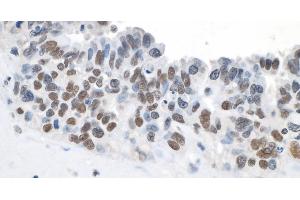 Immunohistochemistry (IHC) image for anti-Topoisomerase (DNA) II beta 180kDa (TOP2B) (C-Term) antibody (ABIN7454697) (TOP2B anticorps  (C-Term))