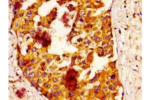 anti-IQ Motif Containing B1 (IQCB1) (AA 445-598) antibody