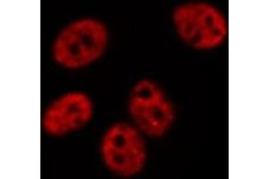 ABIN6275070 staining  Hela cells by IF/ICC.