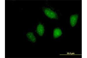 Immunofluorescence of purified MaxPab antibody to LYN on HeLa cell. (LYN anticorps  (AA 1-512))