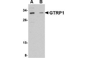 Western Blotting (WB) image for anti-Growth Hormone Regulated TBC Protein 1 (GRTP1) (Middle Region) antibody (ABIN1030945) (GRTP1 anticorps  (Middle Region))