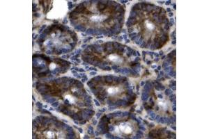 IHC analysis of SLC44A2 using anti-SLC44A2 antibody (ABIN7599530).