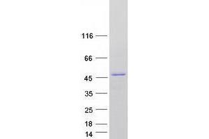 Validation with Western Blot