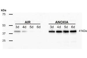 Western Blotting (WB) image for anti-Alcohol Dehydrogenase (ADH) antibody (ABIN7540305)