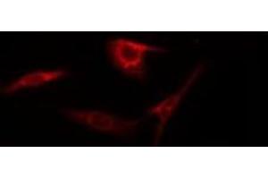 ABIN6275184 staining HepG2 by IF/ICC.