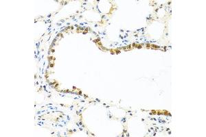 Immunohistochemistry of paraffin-embedded rat lung using APCS antibody at dilution of 1:100 (40x lens). (APCS anticorps)