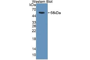 Detection of Recombinant RGS6, Rat using Polyclonal Antibody to Regulator Of G Protein Signaling 6 (RGS6)