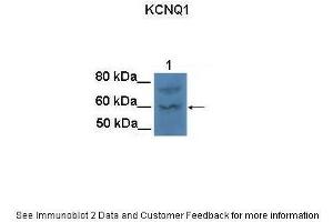 Lanes:   100 ug CHO cell lysate  Primary Antibody Dilution:   1:1000  Secondary Antibody:   Goat anti-rabbit HRP  Secondary Antibody Dilution:   1:25000  Gene Name:   KCNQ1  Submitted by:   Anonymous (KCNQ1 anticorps  (N-Term))