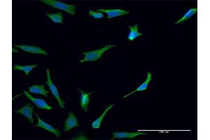 Immunofluorescence of monoclonal antibody to TGM2 on HeLa cell.